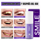 Blanqueador Dental SMILE V34 | ¡Compra 1 y Llévate 2!