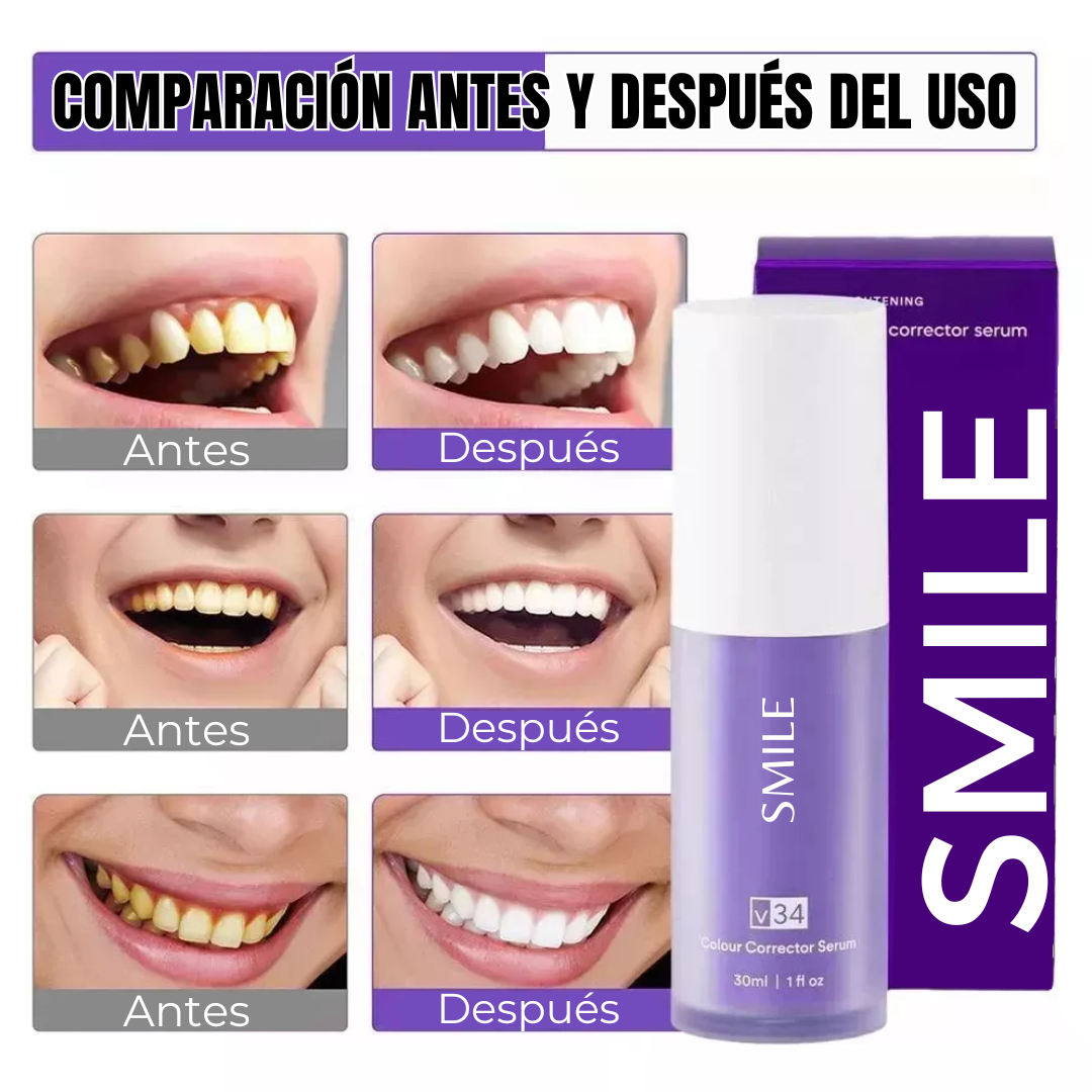 Blanqueador Dental SMILE V34 | ¡Compra 1 y Llévate 2!